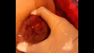 127 fisting porn videos